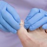 Nagelregulatie